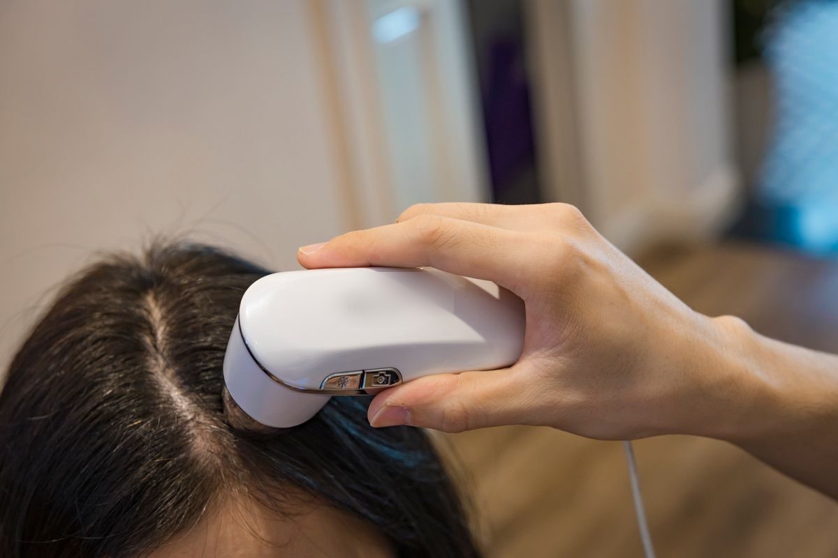 Examen du cuir chevelu à l’aide d’un dermoscope, technique utilisée pour orienter le diagnostic d’alopécie de traction.