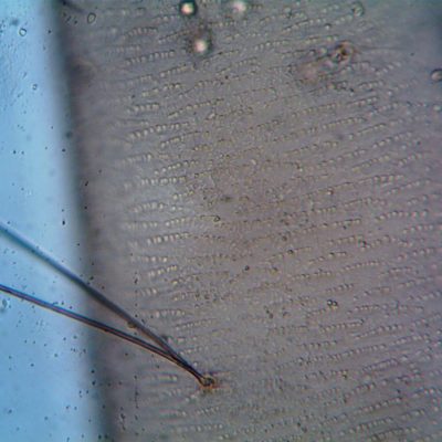 Microneedling cheveux avis : ce que la littérature mesure vraiment