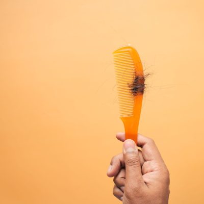 Dès que la chute de cheveux dépasse 100 par jour, faut-il s&rsquo;inquiéter ?