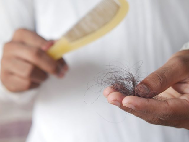 Dès maintenant, comment financer vos prothèses capillaires sans stress